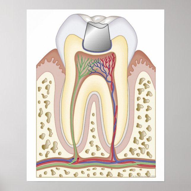 Poster Ilustração do preenchimento dentário (Frente)