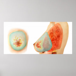 Poster Ilustração médica do peito fêmea