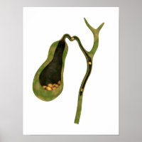 Imagem Conceitual Da Gola Dentro Gallstones