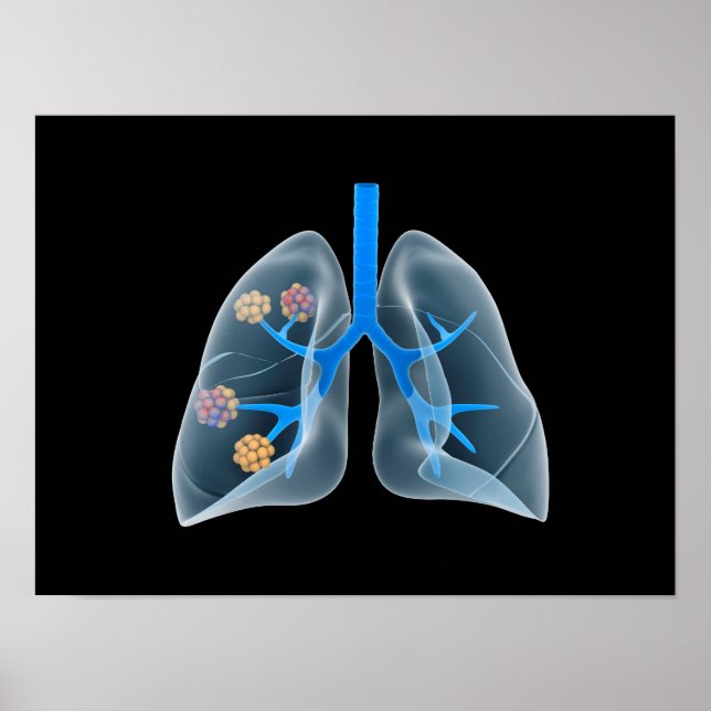 Poster Imagem Conceitual Do Coração Humano 4 (Frente)