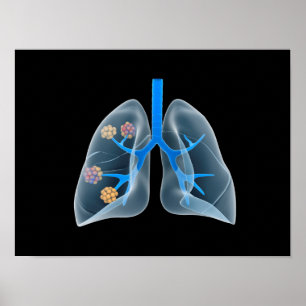 Poster Imagem conceptual do coração humano 4