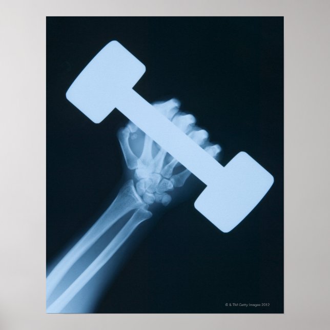 Póster Imagem de raio-X da mão humana com peso, aproximaç (Frente)