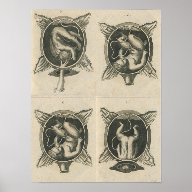 Poster Justine Siegemund Court Parteira Bebê Parto (Frente)