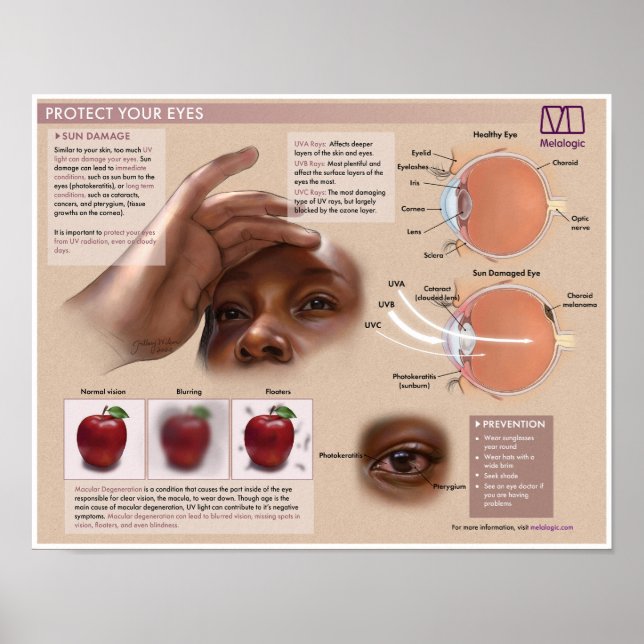 Poster Médico de Proteção dos Olhos Melálicos (Frente)