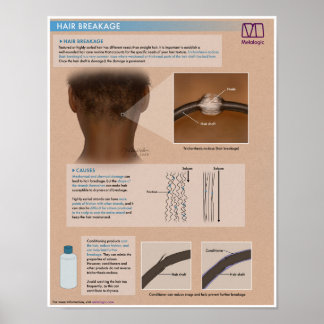 Poster Médico de Quebra do Cabelo Melalógico