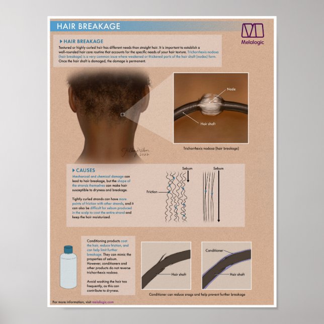 Poster Médico de Quebra do Cabelo Melalógico (Frente)
