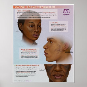 Poster Médico do Relâmpago de Pele Melálico