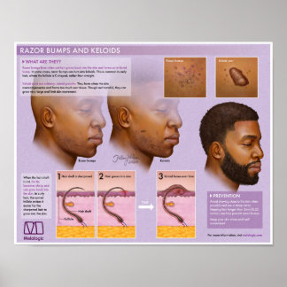 Poster Médico Melalogico de Razor e Keloids