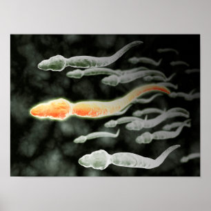 Poster Microscopic View Of Sperm Traveling