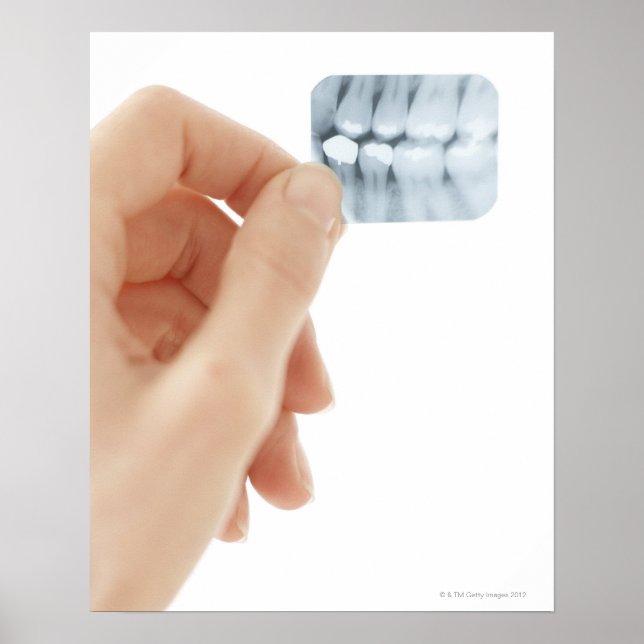 Póster MODELO LIBERADO. Radiografia dentária. (Frente)