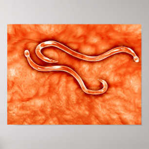 Póster Opinião microscópica o Hookworm 2