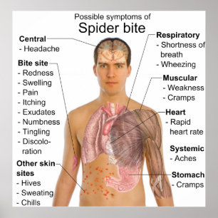 Poster Os sintomas comuns na aranha venenosa mordem a
