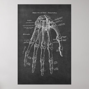 Poster Ossos da Anatomia da Superfície Palmar da Esquerda