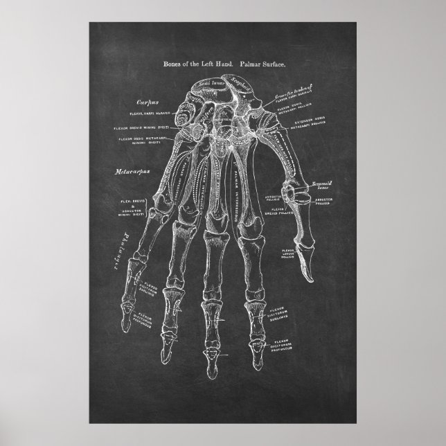 Poster Ossos da Anatomia da Superfície Palmar da Esquerda (Frente)