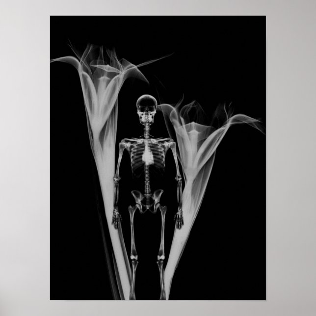 Poster Pequeno Esqueleto de Raio X humano e flores - B&W (Frente)