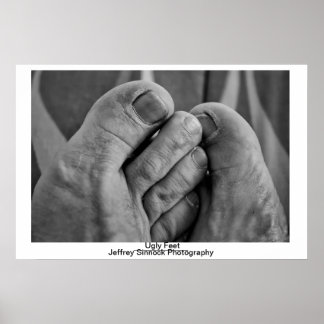 Póster Pés Feitos Feios