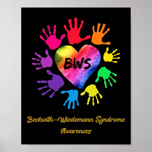 Poster Porque com a Síndrome de Wiedemann a consciência é (Frente)