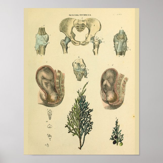 Poster Posição Fetal Anatomia do pélvis Anatomia do pânta (Frente)