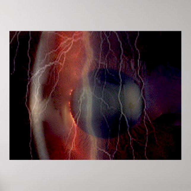 Poster Pôster de Relâmpago Sobre uma Córnea Rasgada (Frente)
