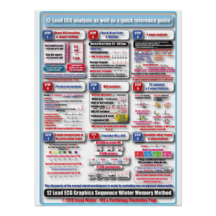 Póster Poster de treinamento de ECG
