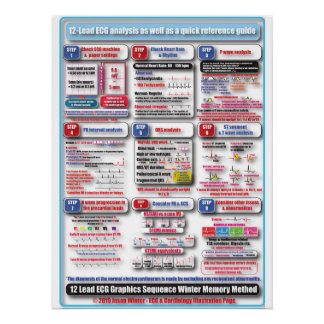 Póster POSTER de treinamento ECG
