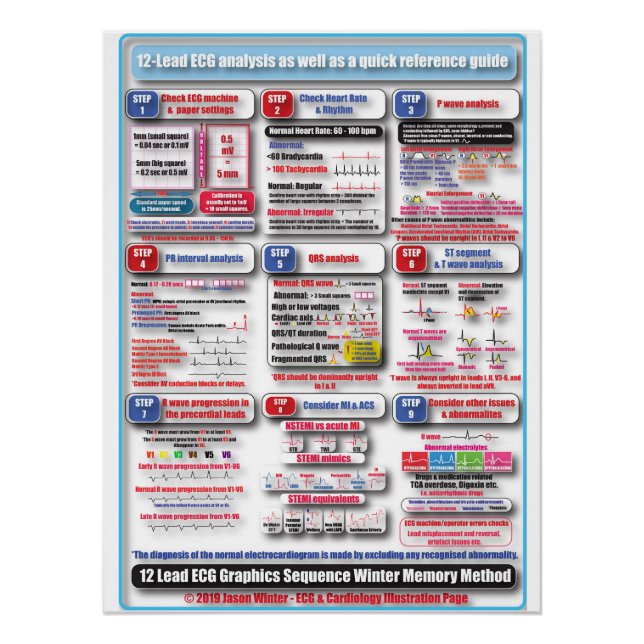 Póster POSTER de treinamento ECG (Frente)