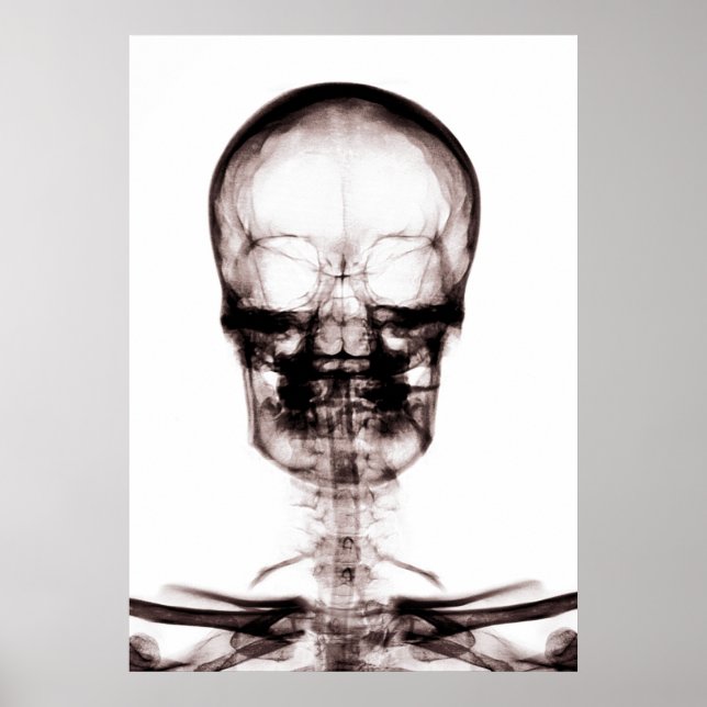 PÓSTER POSTER/IMPRESSÃO X RAY VISION SKELETON SKULL ORIG/ (Frente)