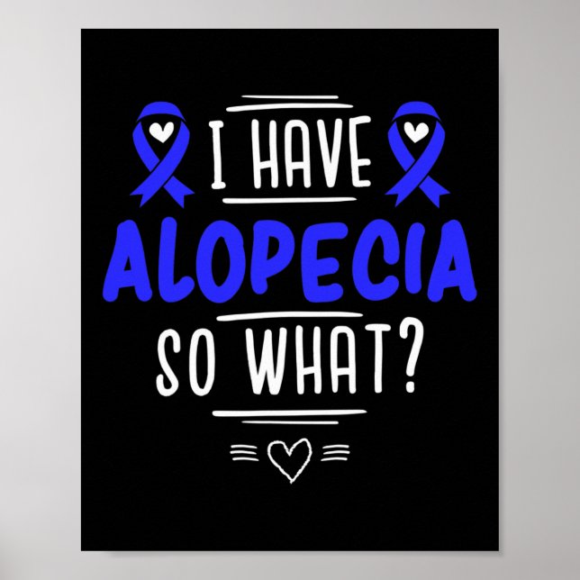 Poster Presente para Doentes com Calvície Spot Perda de C (Frente)