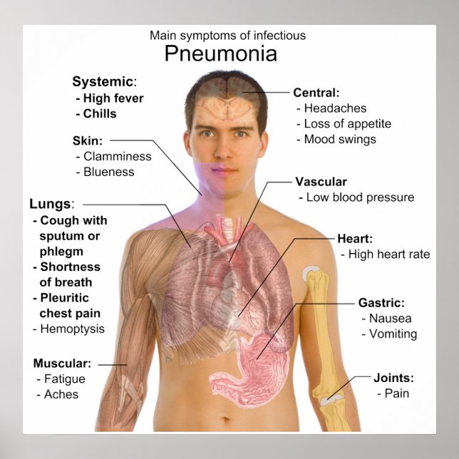Póster Principais sintomas do diagrama pneumonia infeccio (Frente)