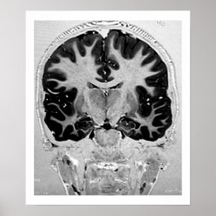 Poster principal de MRI