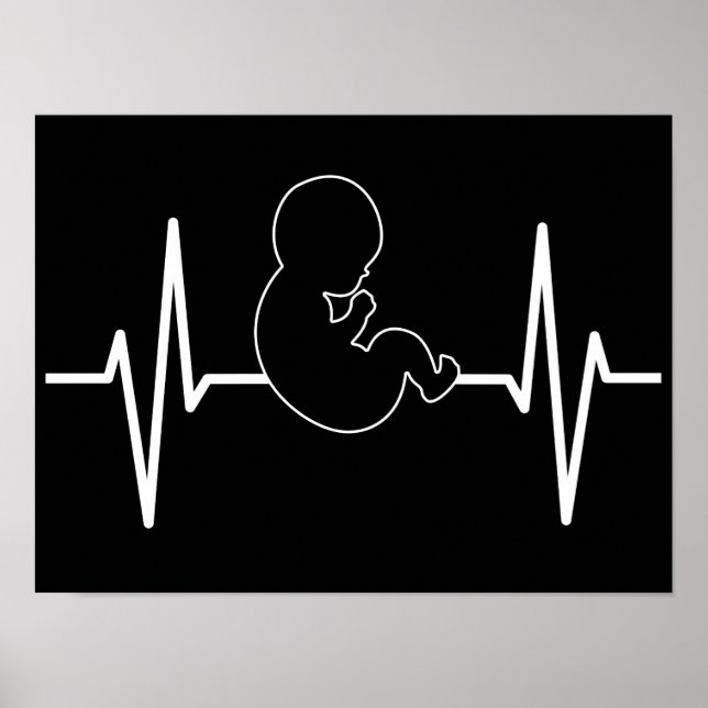 Poster Pulso De Pulso De Bebê Pro-Life EKG: Fé Cristã (Frente)