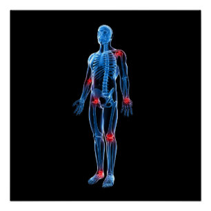 Póster Raio X humano