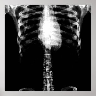 PÓSTER REFORÇOS DE ESQUELETO DO TORSO DO RAIO X - B&W