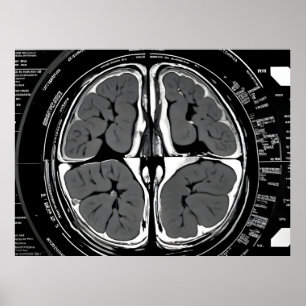Poster ressonância magnética cerebral