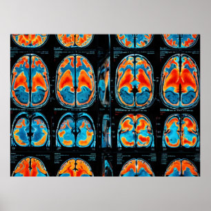 Poster ressonância magnética cerebral