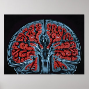 Poster ressonância magnética cerebral
