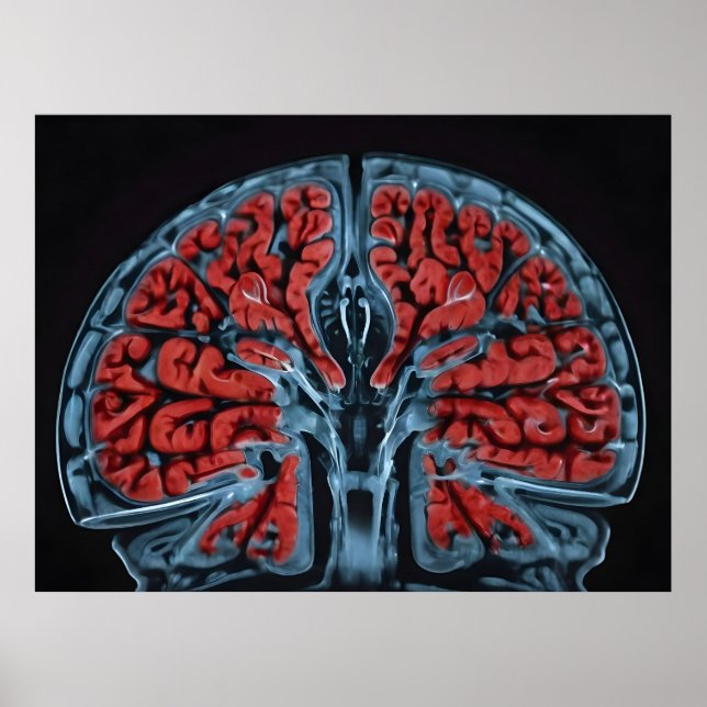 Poster ressonância magnética cerebral (Frente)