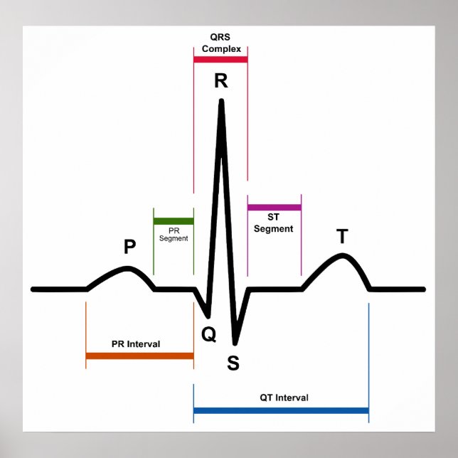 Poster Ritmo sinusal num diagrama ECG eletrocardiograma (Frente)
