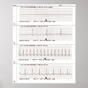 Póster ritmos do ekg