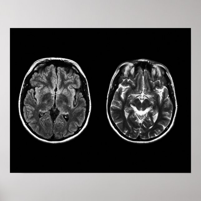 Poster Scanner mri do cérebro (Frente)
