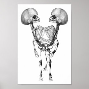 Poster Siameses siameses unidos Anatomia Artes