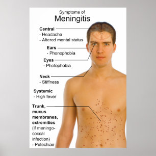 Póster Sintomas Gráfico de Inflamação Doença Meningite