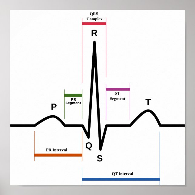 Poster Sinus Rhythm Eletrocardiograma ECG (Frente)