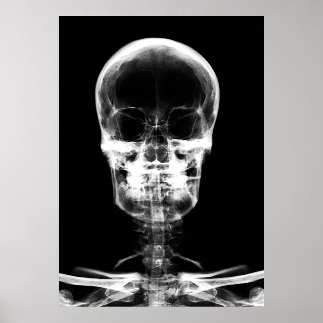 PÓSTER SKELETON DE VISÃO X RAY - B&W (Frente)