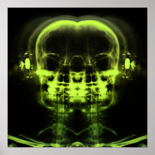 Poster Skulls de raios X duplos com Fones de ouvido - Ver
