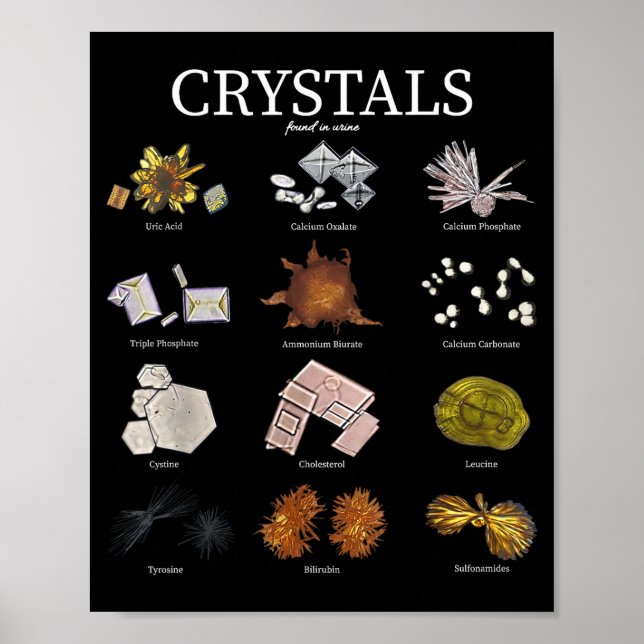 Poster Técnico de Laboratório de Cristal de Urina de Labo (Frente)