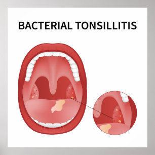 Poster Tossilite bacteriana