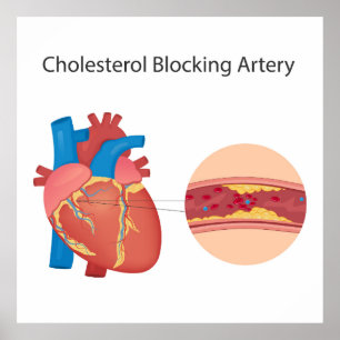 Poster Vasos sanguíneos estreitos