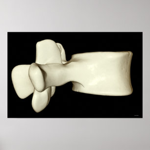 Poster Vertebra lombar 4