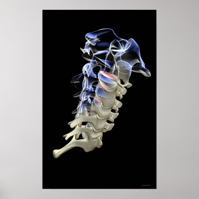 Póster Vertebrae Cervical 4 (Frente)